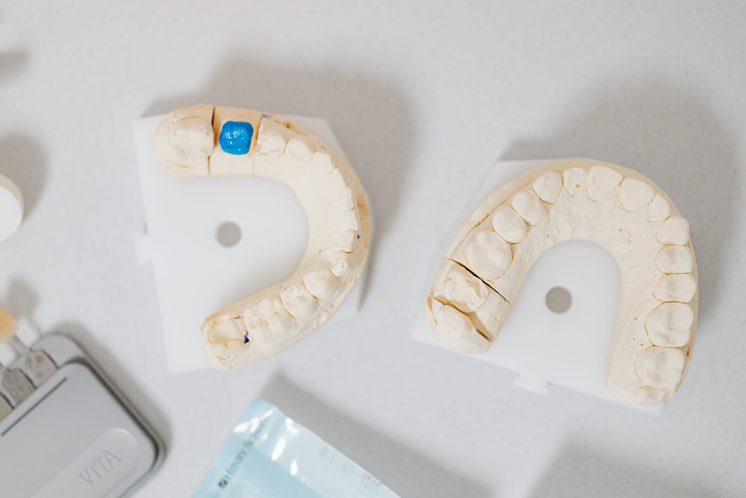 Our Services Close-up of dental molds on a white table, showcasing orthodontic details.