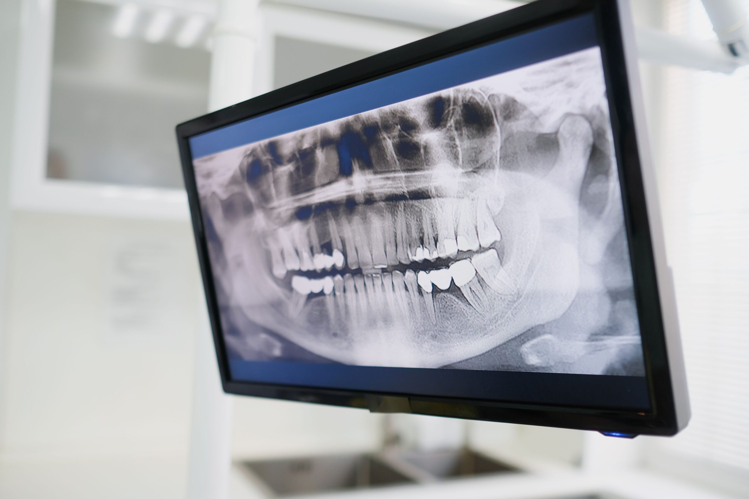 Our Services Close-up of a dental X-ray displayed on a monitor in a dental clinic setting, emphasizing dental care technology.